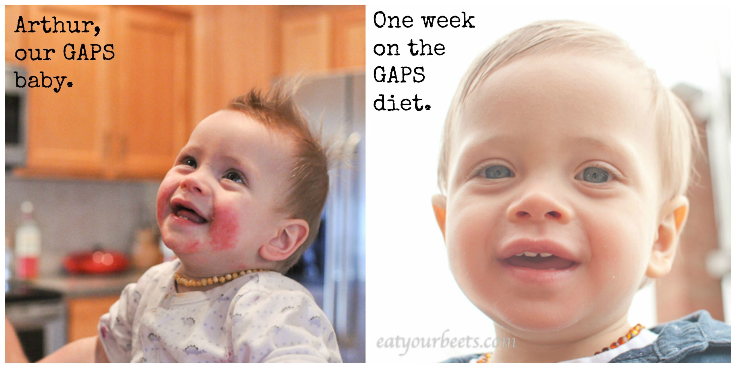 When Foods hurt. When Foods Heal.