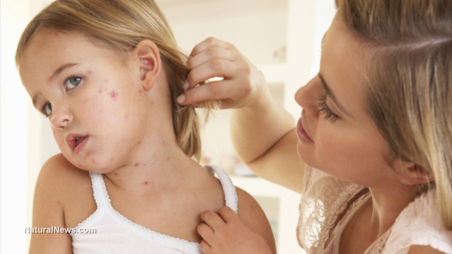 Herd Immunity vs Outbreaks